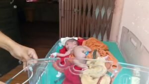 पेड़ के नीचे नवजात का इलाज: डुमराँव अस्पताल&hellip;